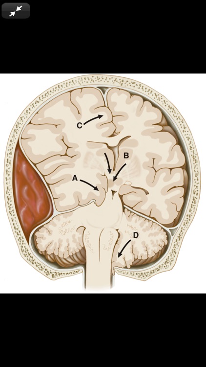 Harrison’s Manual of Med. 20/E screenshot-7