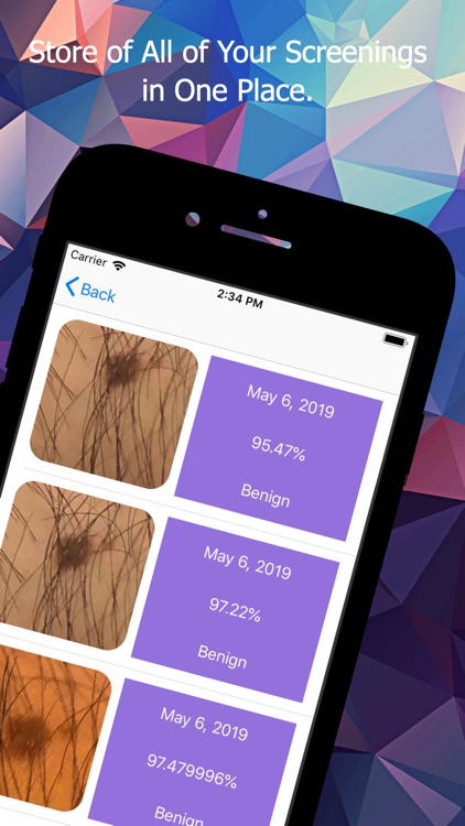 HealthAI - Skin Cancer