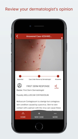 STD Triage Ask dermatologist screenshot