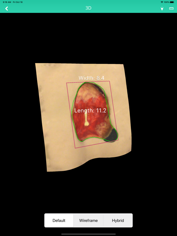 Parable iPad screenshot 5 - Medical app