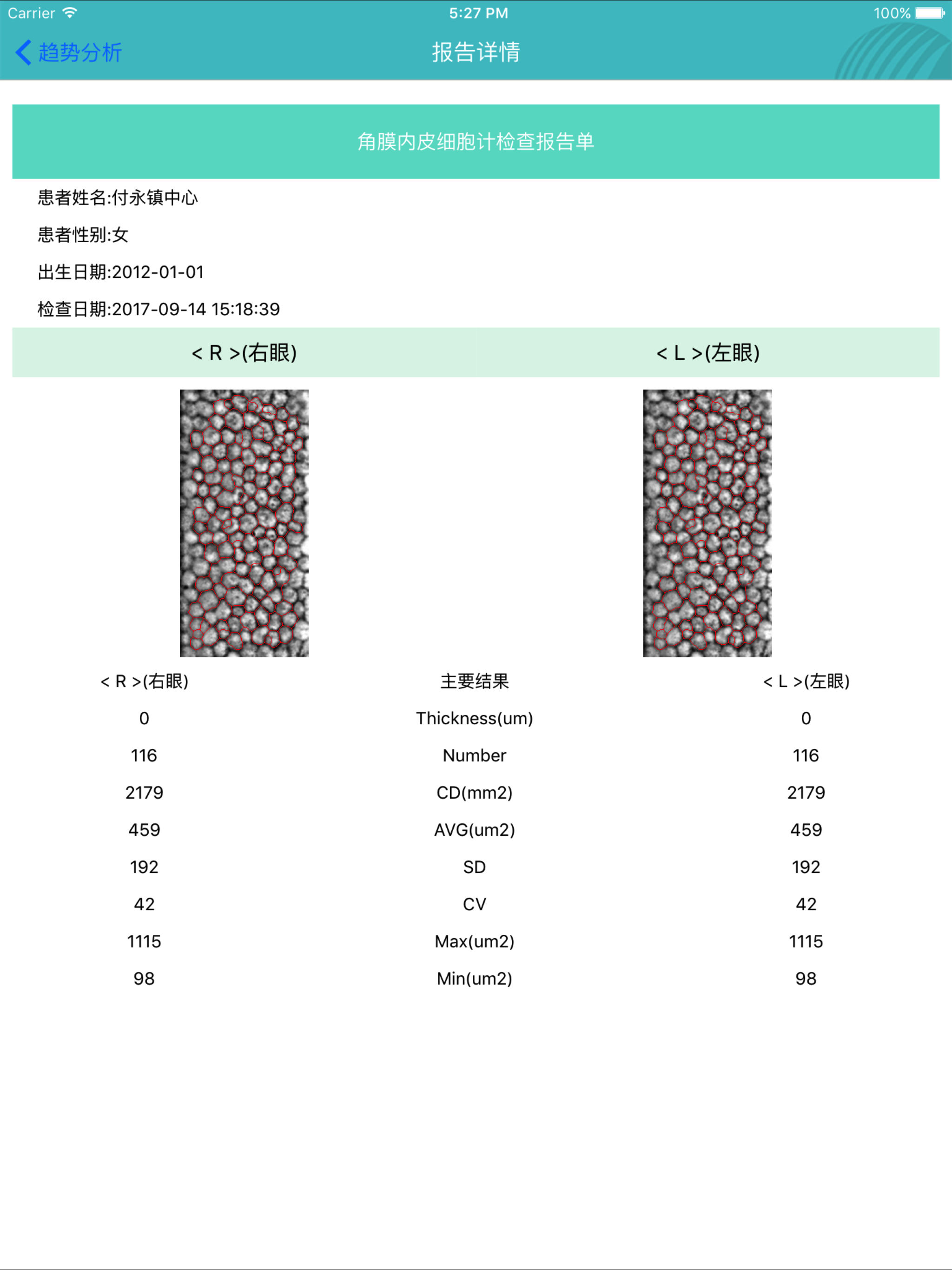 眼健康