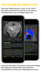 MR Imaging in Prostate Cancer screenshot