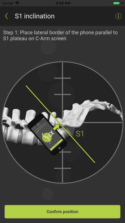 SagittalMeter Pro screenshot-5