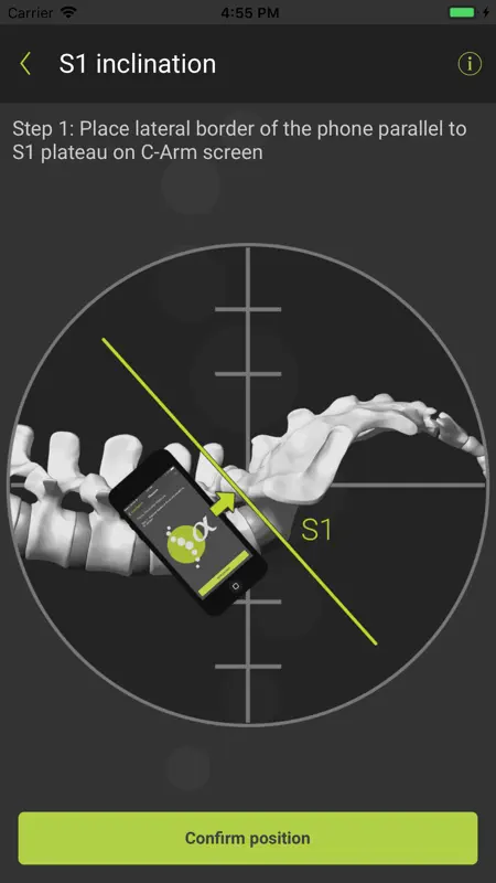 SagittalMeter Pro screenshot 6 of 6