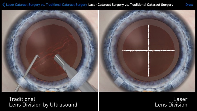 Sight Selector Subscription