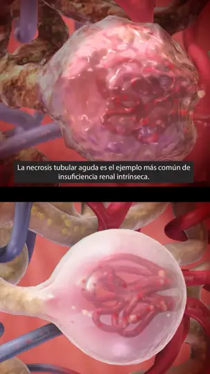 Captura de pantalla de Fisiología & Patología en iPhone 3