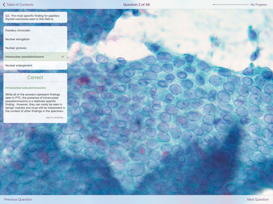 Thyroid Pathology iPad screenshot