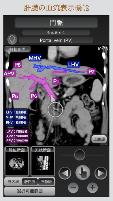 CT Passport 腹部 screenshot1