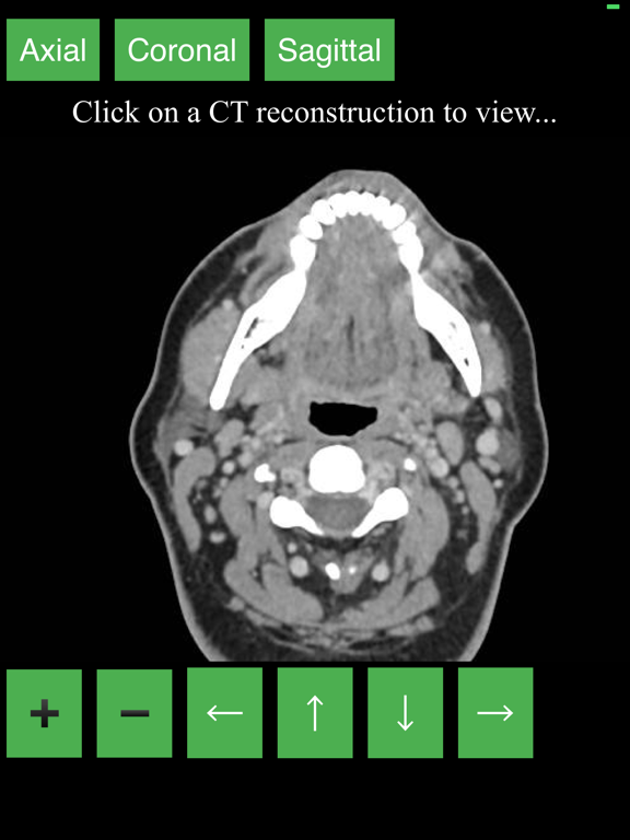 Screenshot #4 pour CT Neck