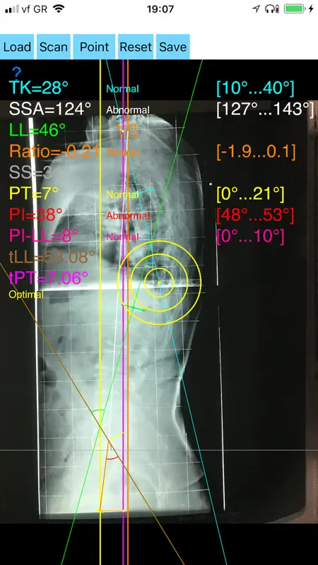 SagittalBalanceApp screenshot 2 of 6