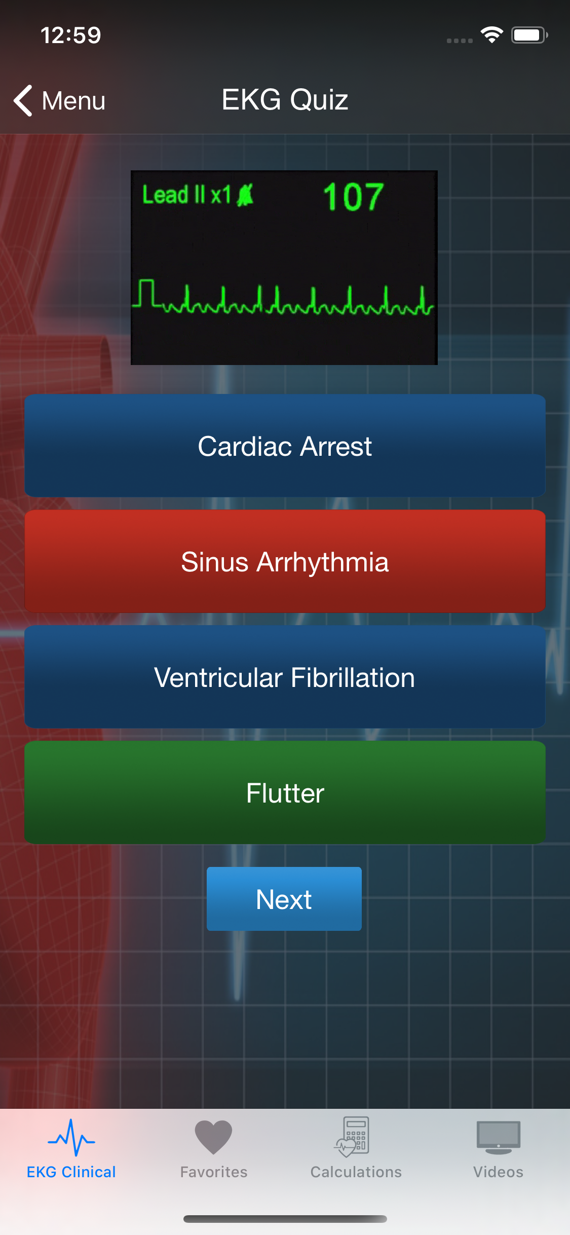 EKG Clinical