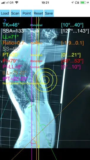 Screenshot von SagittalBalanceApp auf dem iPhone 4