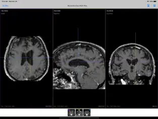 Screenshot 2 IMAIOS Dicom Viewer iphone