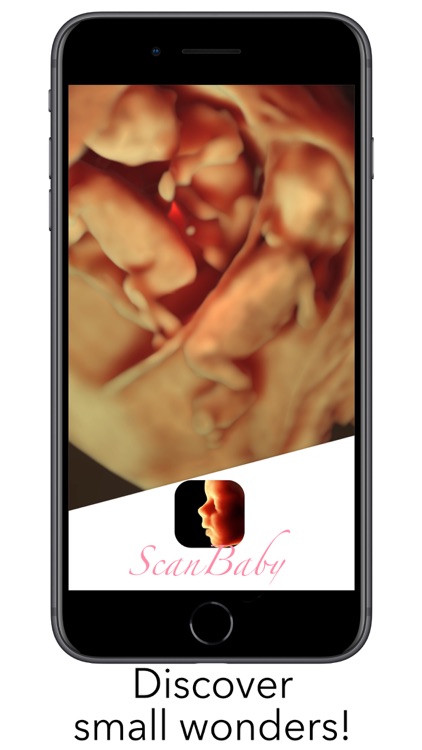 ScanBaby learn baby ultrasound screenshot-0