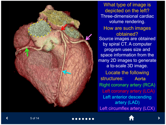 Basic Radiology - SecondLook iPad screenshot 4 - Medical app