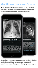 Radiology - Thoracic Imaging screenshot