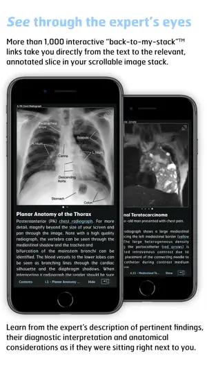 Radiology - Thoracic Imaging screenshot 4