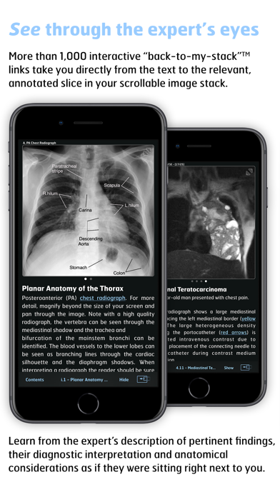 Radiology - Thoracic Imaging Screenshot