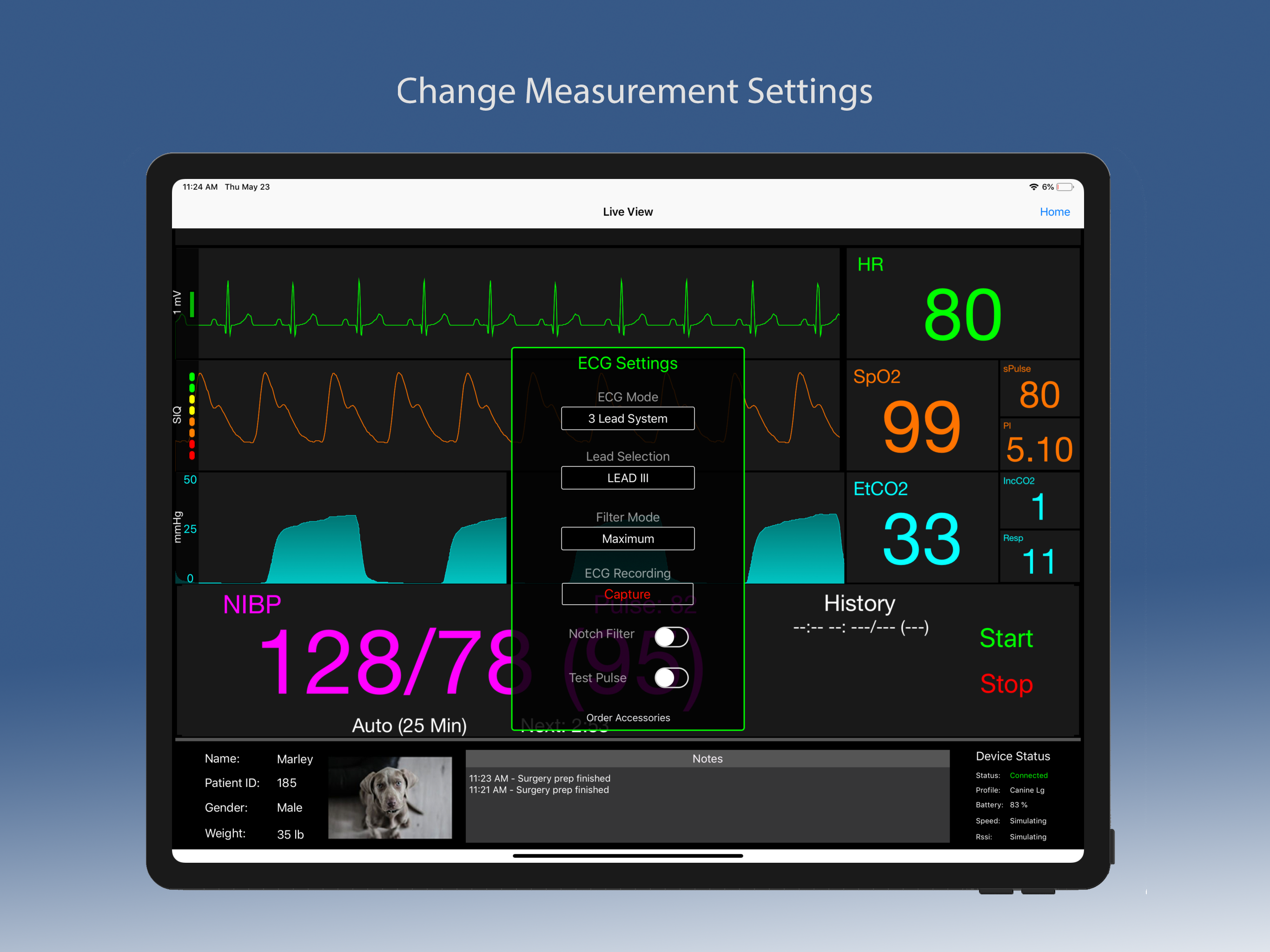 LifeWindow App screenshot 3