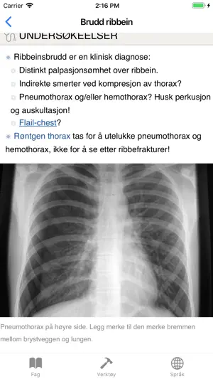 Skadehåndboka screenshot 3