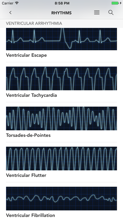 Screenshot #1 pour Instant ECG - Mastery of EKG
