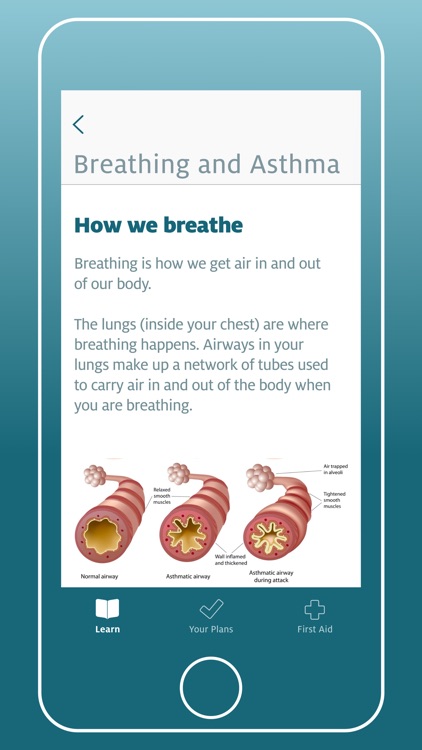 My Asthma App