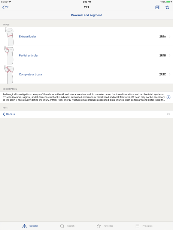Screenshot #5 pour AO/OTA Fracture Classification