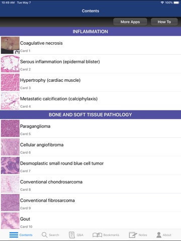 Anatomic Pathology Flashcardsのおすすめ画像2