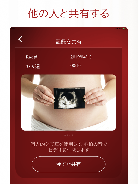 赤ちゃんの心拍を聞く My Baby S Beat By Matis O M G Ltd Ios 日本 Searchman アプリマーケットデータ