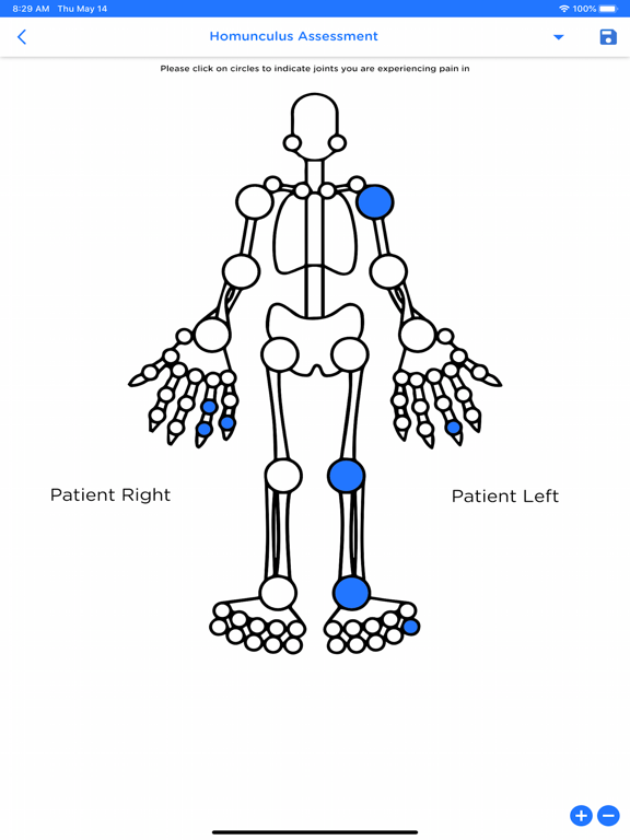 Arthritis+ Patient iPad screenshot 9 - Medical app