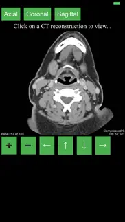 How to cancel & delete ct neck 1