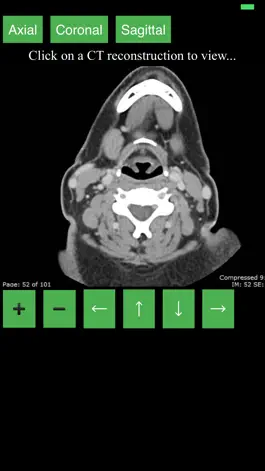 Game screenshot CT Neck mod apk