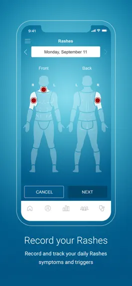 Game screenshot Psoriasis Monitor hack