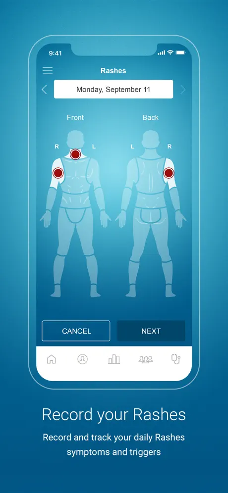 Psoriasis Monitor