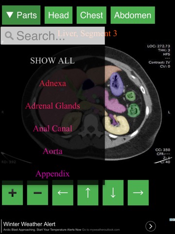 Anatomy on Radiology CTのおすすめ画像3