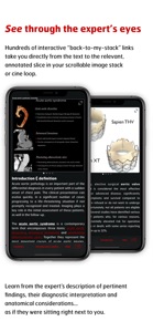 Radiology - Aortic Imaging screenshot #4 for iPhone
