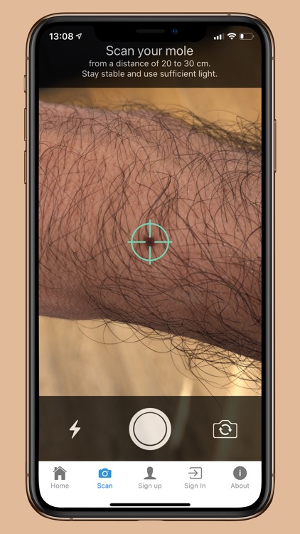 DermoScanner