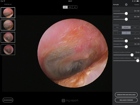 Screenshot #5 pour MyReport pour iCare