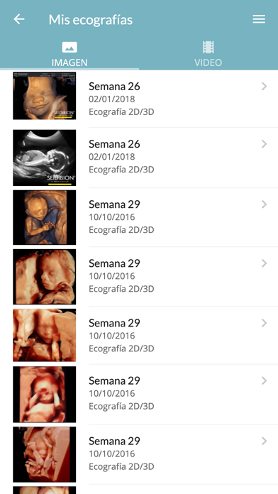 Screenshot #3 pour Clínica Montesinos - Gestación