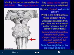 Neuroanatomy - SecondLook iPad image 4
