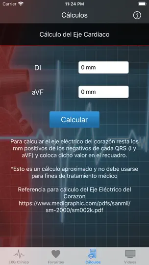 Captura de pantalla de EKG Clínico en iPhone 6