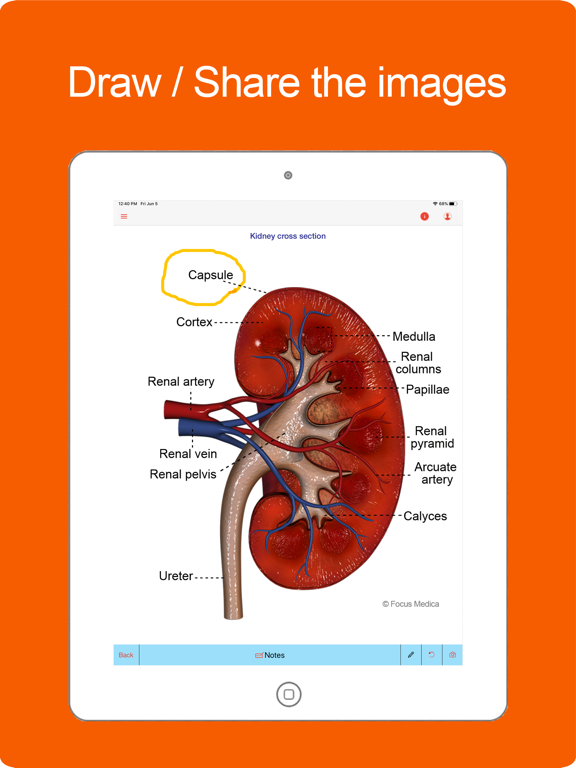 Screenshot #6 pour Silodal - Atlas of Nephrology