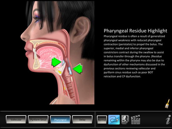 Screenshot #5 pour Residue Disorders