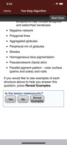Dermoscopy Two Step Algorithm screenshot #3 for iPhone