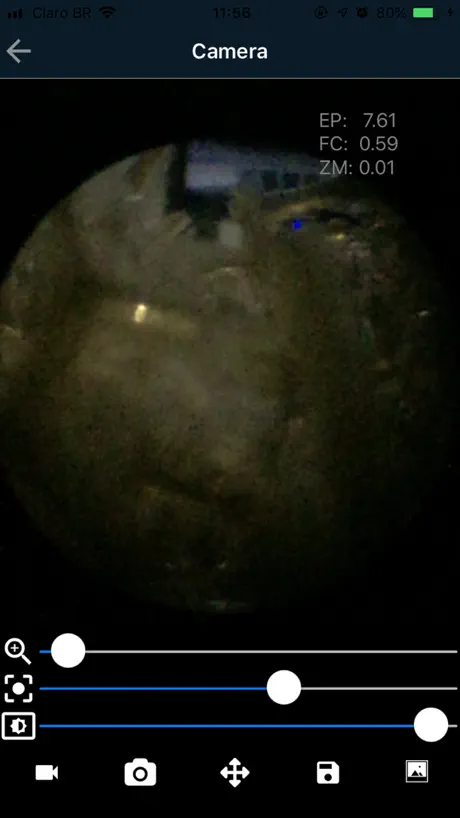 M-Scope - Mobile Endoscope