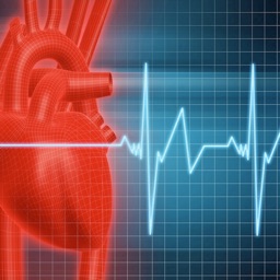 EKG Clinical