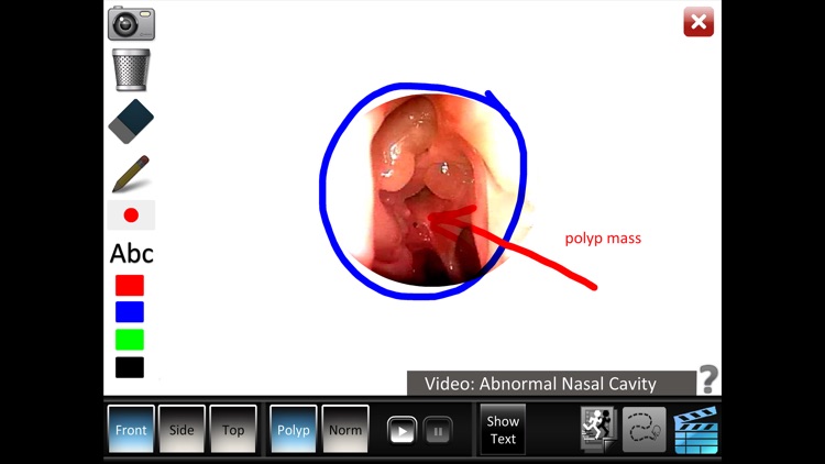 Sinus ID screenshot-4