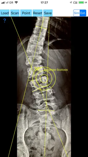 Screenshot von CobbAngleApp auf dem iPhone 5