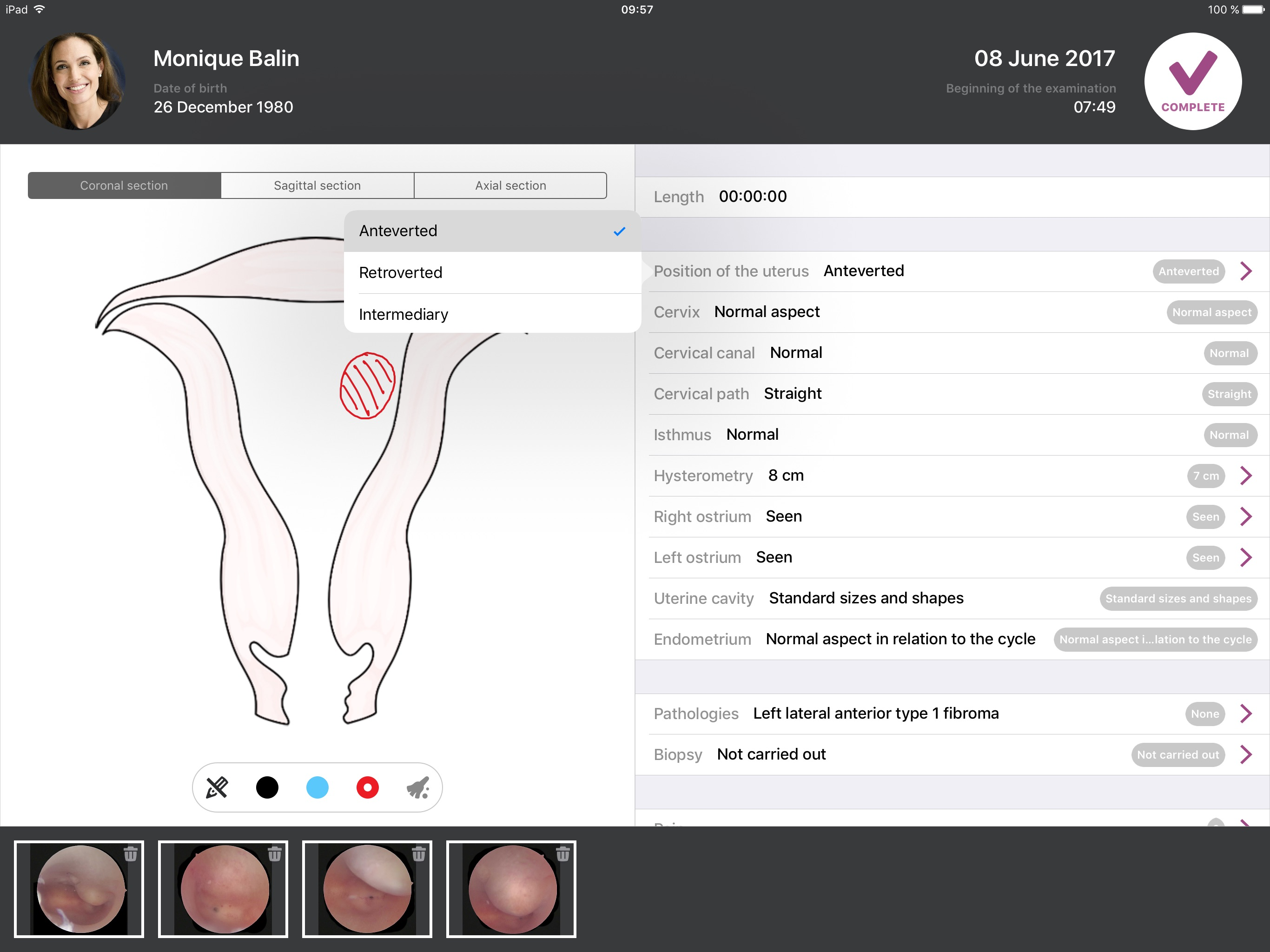 imagyn for iCare screenshot 3