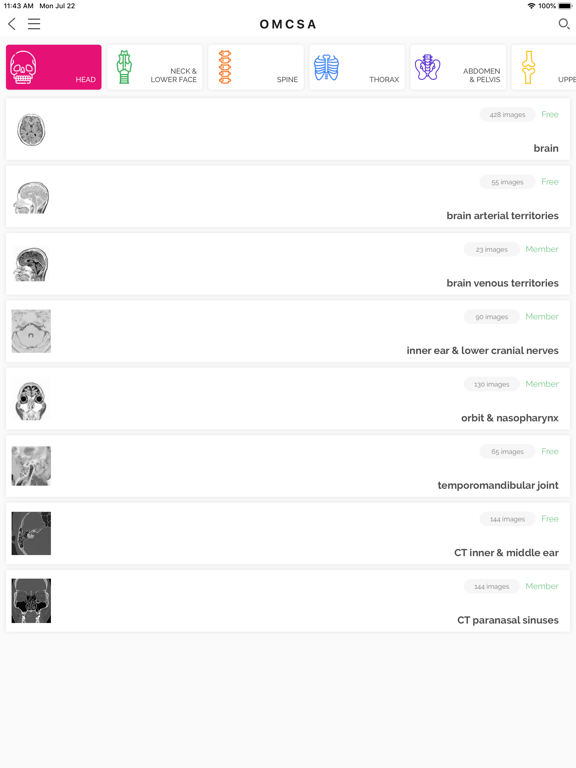 Screenshot #6 pour OMCSA k-anatomy